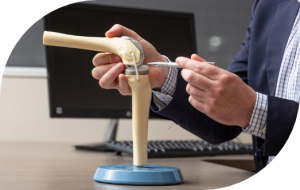 Knee anatomical model used to explain knee replacement recovery