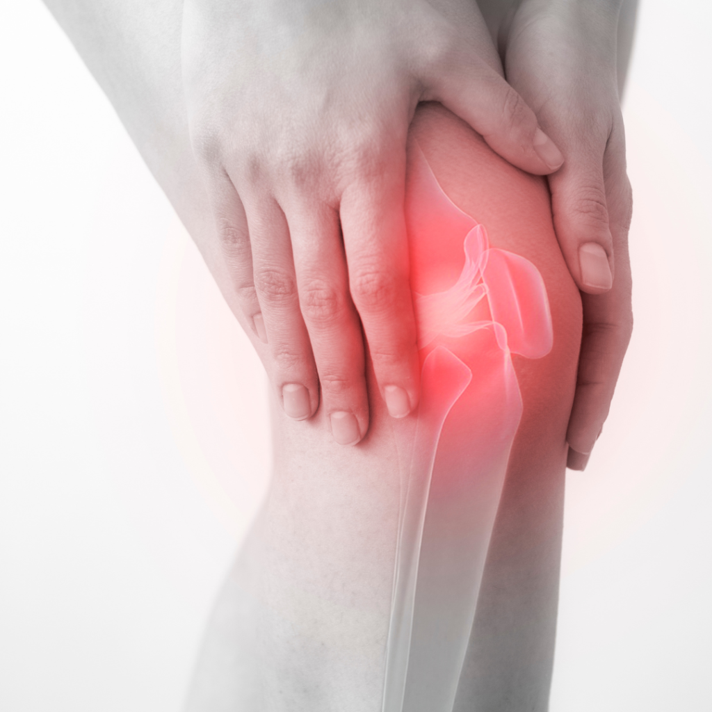Illustration of knee pain commonly associated with a meniscus tear