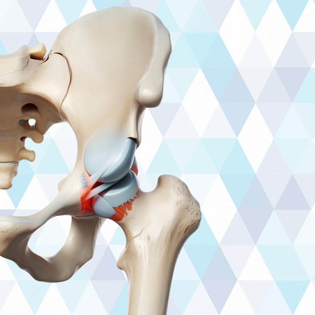 Hip joint anatomy showing early signs of arthritis with cartilage wear and bone spurs