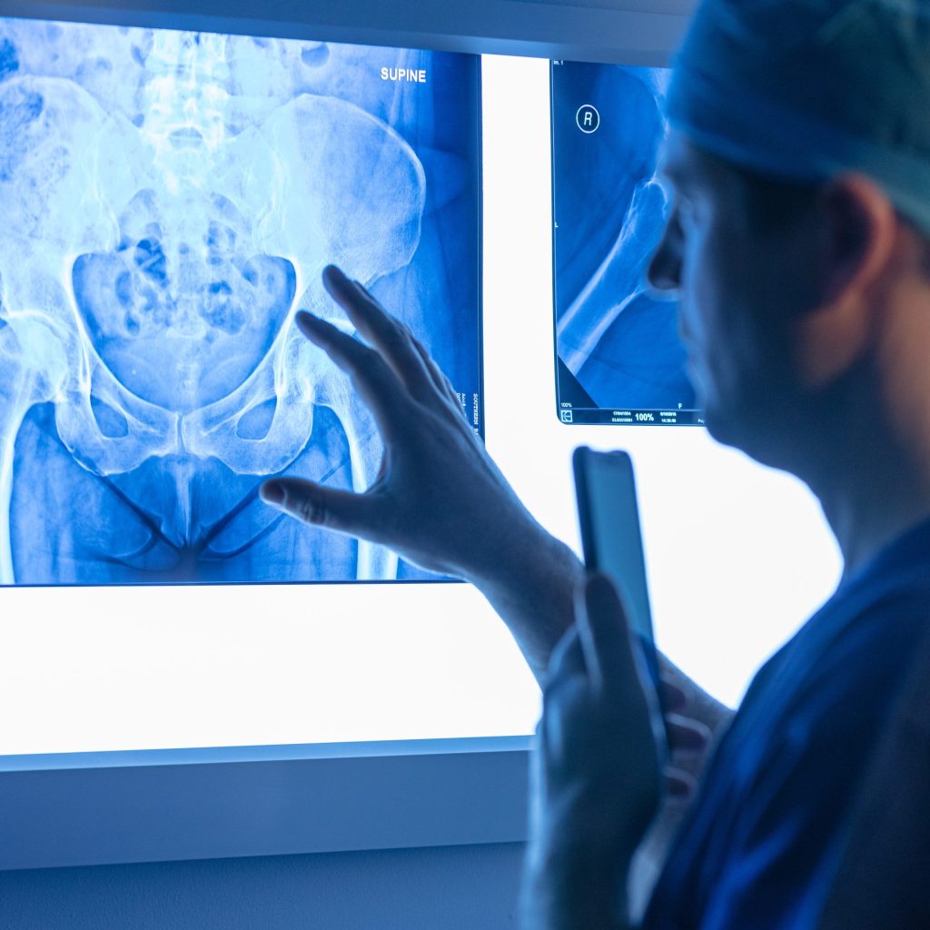 hip joint relevant to resurfacing surgery