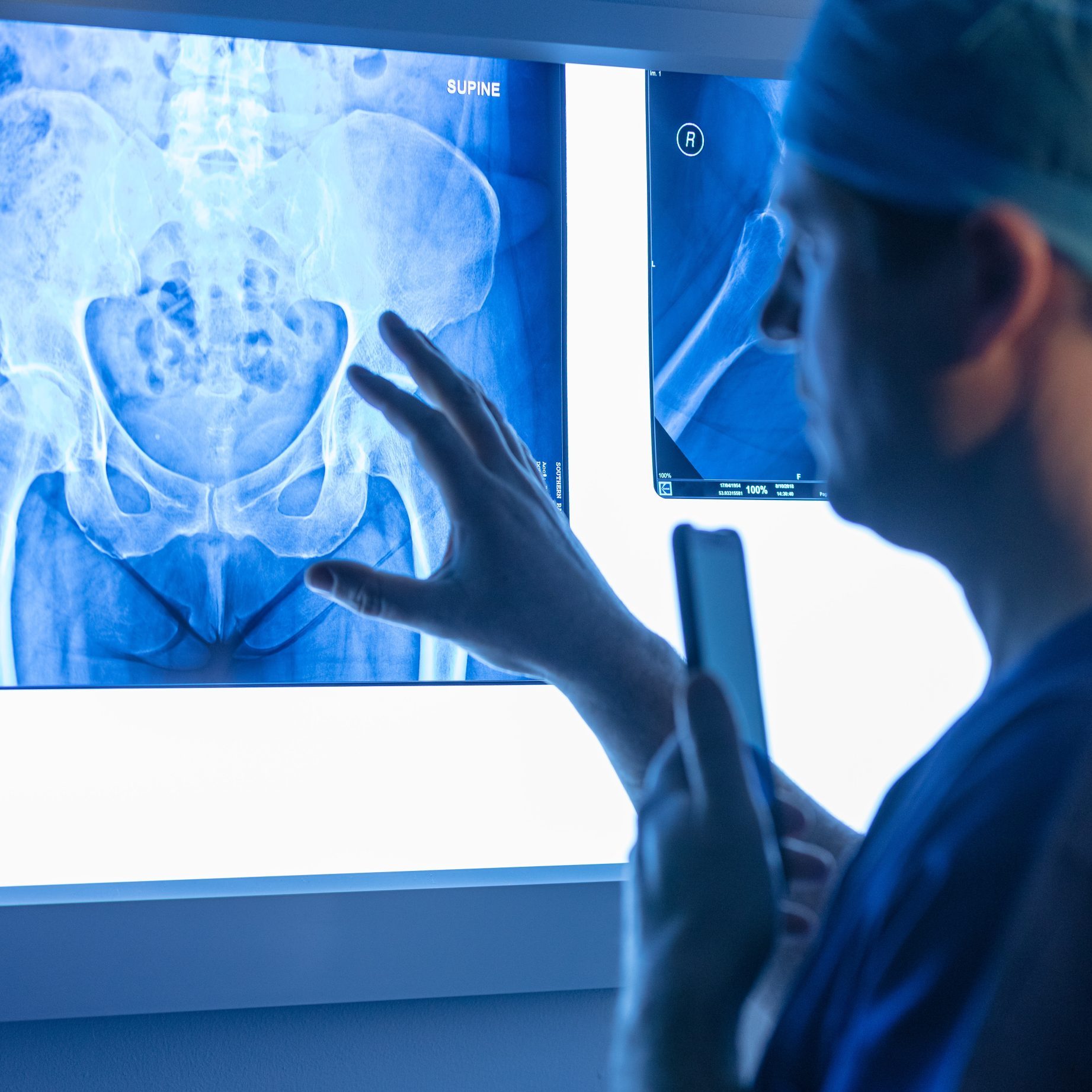hip joint relevant to resurfacing surgery